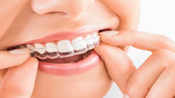 Orthodontic Treatment